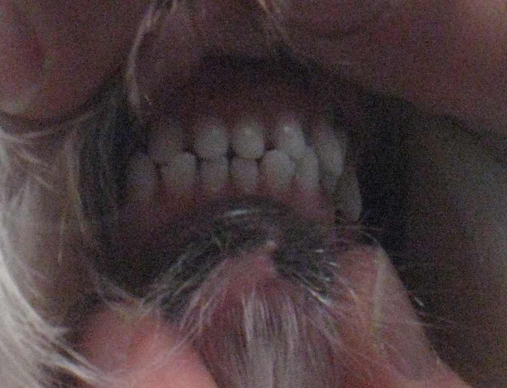 teeth1